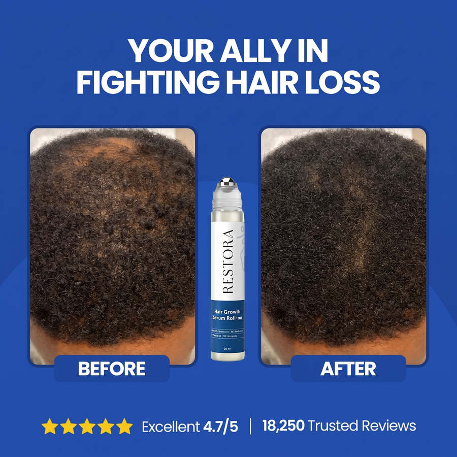 Advanced Hair Growth Roll-on Serum — 7